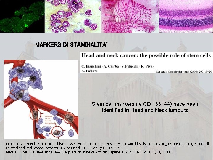 MARKERS DI STAMINALITA’ Stem cell markers (ie CD 133; 44) have been identified in