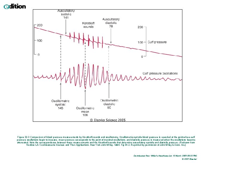 Figure 32 -3 Comparison of blood pressure measurements by Korotkoff sounds and oscillometry. Oscillometric Figure 32 -3 Comparison of blood pressure measurements by Korotkoff sounds and oscillometry. Oscillometric