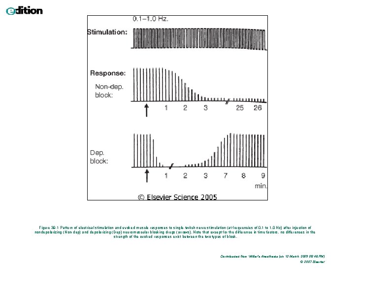 Figure 39 -1 Pattern of electrical stimulation and evoked muscle responses to single-twitch nerve Figure 39 -1 Pattern of electrical stimulation and evoked muscle responses to single-twitch nerve