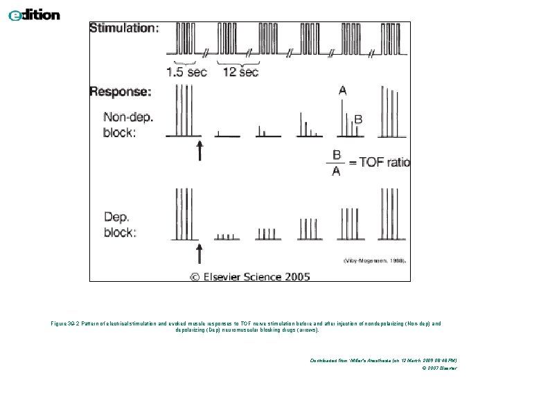 Figure 39 -2 Pattern of electrical stimulation and evoked muscle responses to TOF nerve Figure 39 -2 Pattern of electrical stimulation and evoked muscle responses to TOF nerve