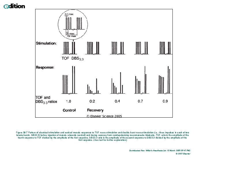 Figure 39 -7 Pattern of electrical stimulation and evoked muscle responses to TOF nerve Figure 39 -7 Pattern of electrical stimulation and evoked muscle responses to TOF nerve