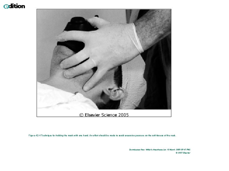 Figure 42 -4 Technique for holding the mask with one hand. An effort should Figure 42 -4 Technique for holding the mask with one hand. An effort should