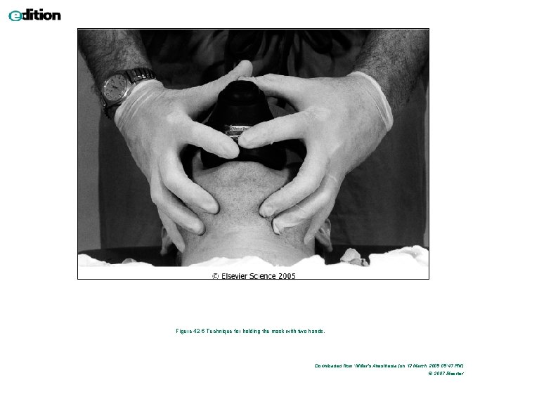 Figure 42 -6 Technique for holding the mask with two hands. Downloaded from: Miller's Figure 42 -6 Technique for holding the mask with two hands. Downloaded from: Miller's