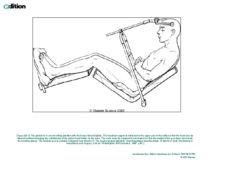 Figure 28 -13 The patient is in a semi-sitting position with the knees flexed Figure 28 -13 The patient is in a semi-sitting position with the knees flexed