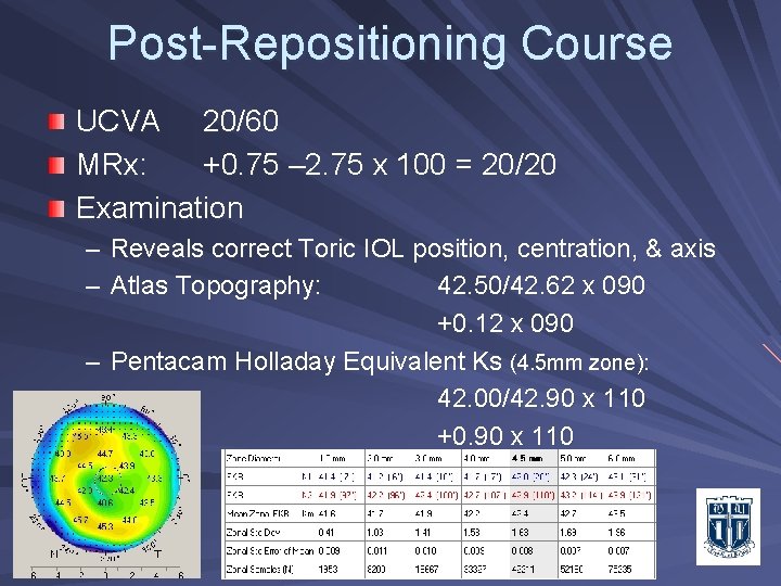 Post-Repositioning Course UCVA 20/60 MRx: +0. 75 – 2. 75 x 100 = 20/20