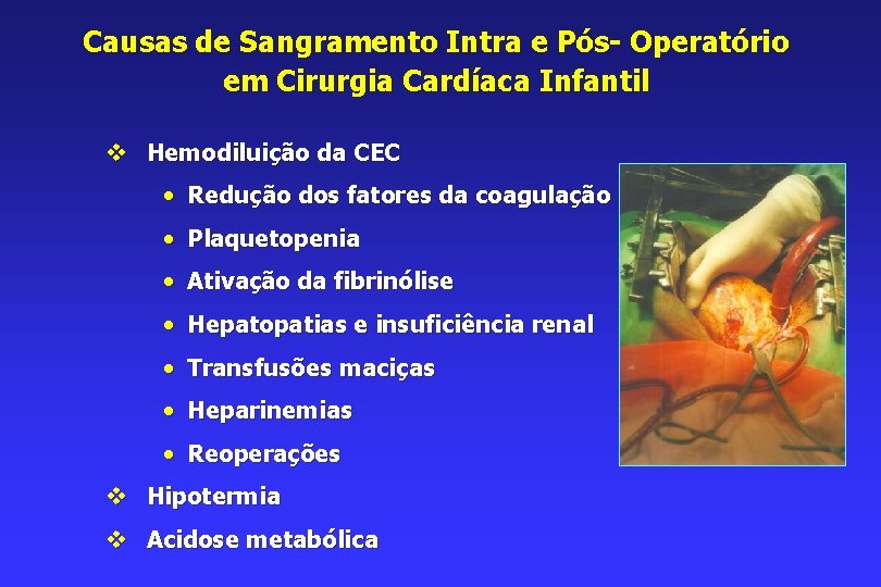 Causas de Sangramento Intra e Pós- Operatório em Cirurgia Cardíaca Infantil v Hemodiluição da