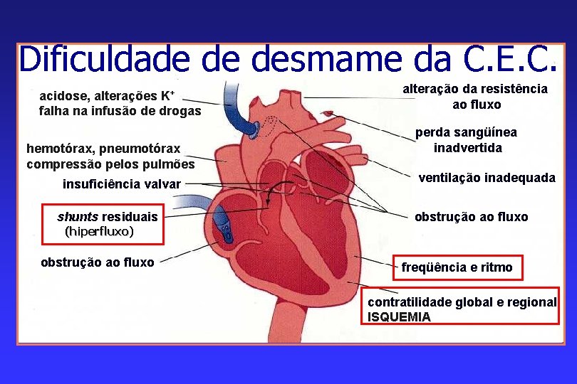Dificuldade de desmame da C. E. C. acidose, alterações K+ falha na infusão de