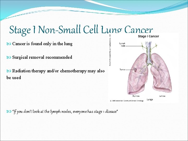 Stage I Non-Small Cell Lung Cancer is found only in the lung Surgical removal