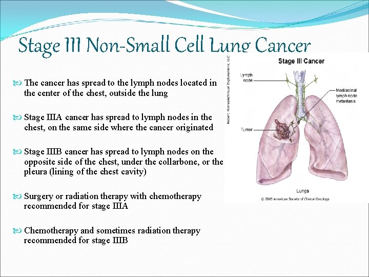 Stage III Non-Small Cell Lung Cancer The cancer has spread to the lymph nodes