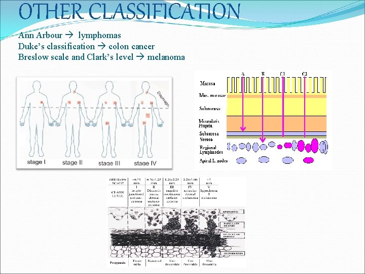 OTHER CLASSIFICATION Ann Arbour lymphomas Duke’s classification colon cancer Breslow scale and Clark’s level