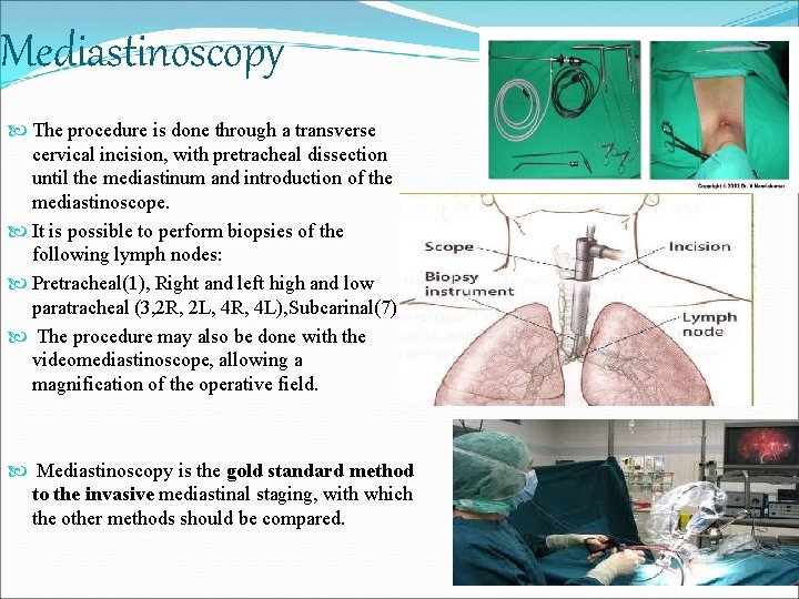 Mediastinoscopy The procedure is done through a transverse cervical incision, with pretracheal dissection until