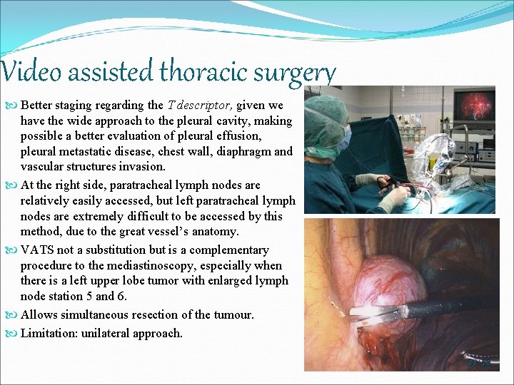 Video assisted thoracic surgery Better staging regarding the T descriptor, given we have the
