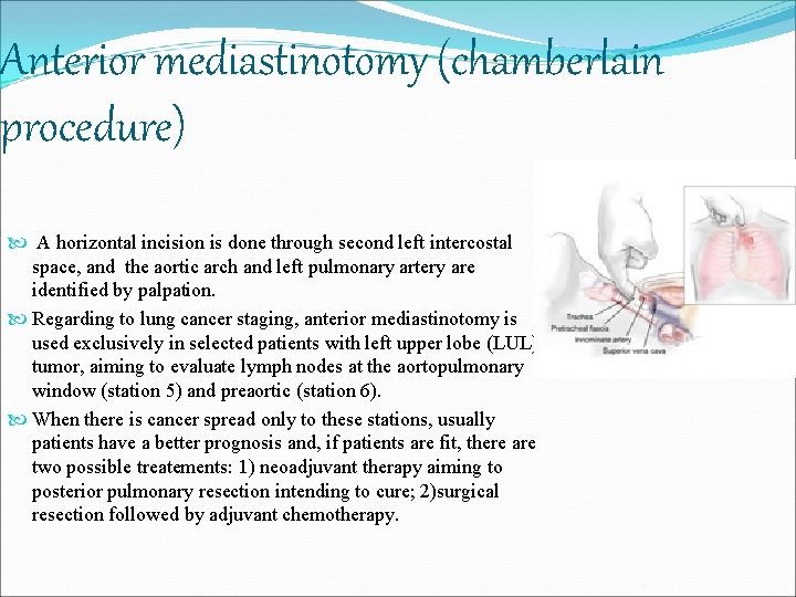 Anterior mediastinotomy (chamberlain procedure) A horizontal incision is done through second left intercostal space,