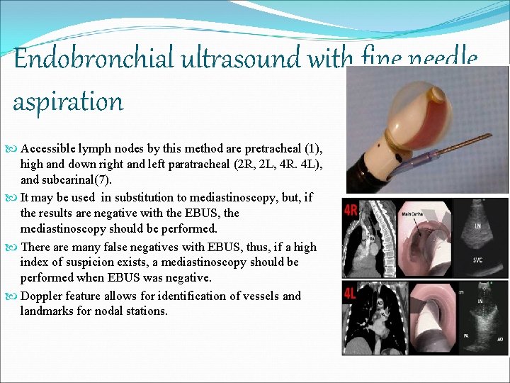 Endobronchial ultrasound with fine needle aspiration Accessible lymph nodes by this method are pretracheal