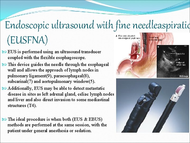 Endoscopic ultrasound with fine needleaspiratio (EUSFNA) EUS is performed using an ultrasound transducer coupled