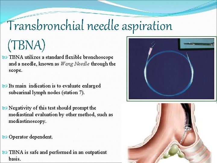 Transbronchial needle aspiration (TBNA) TBNA utilizes a standard flexible bronchoscope and a needle, known