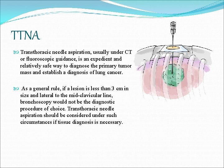 TTNA Transthoracic needle aspiration, usually under CT or fluoroscopic guidance, is an expedient and