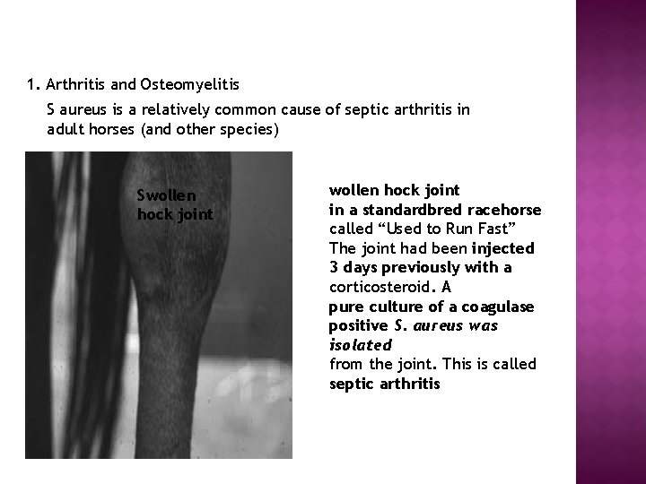 1. Arthritis and Osteomyelitis S aureus is a relatively common cause of septic arthritis