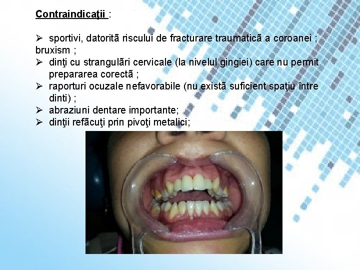 Contraindicaţii : Ø sportivi, datoritã riscului de fracturare traumaticã a coroanei ; bruxism ;