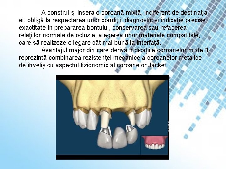 A construi şi insera o coroanã mixtã, indiferent de destinaţia ei, obligã la respectarea