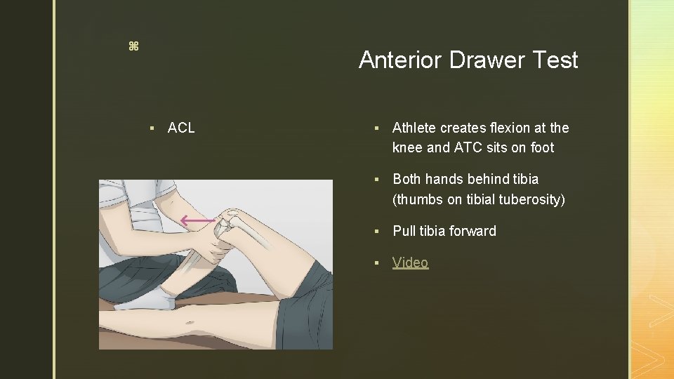 z Anterior Drawer Test § ACL § Athlete creates flexion at the knee and