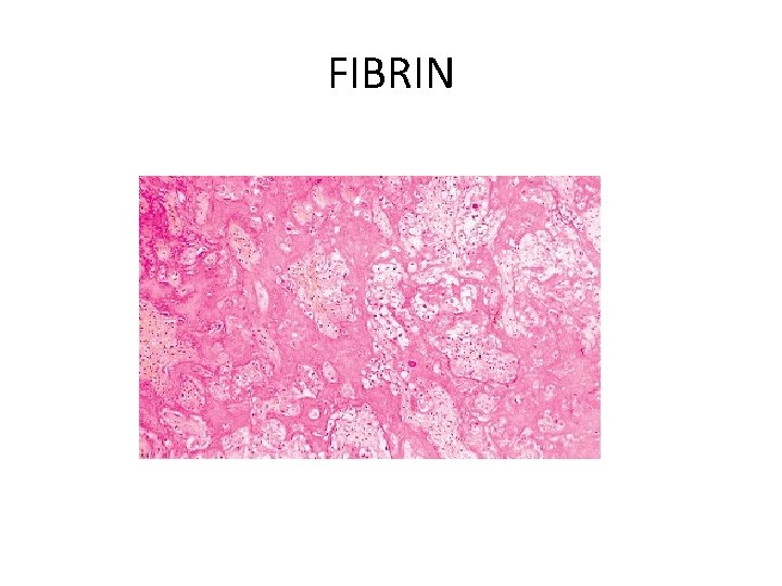 FIBRIN 