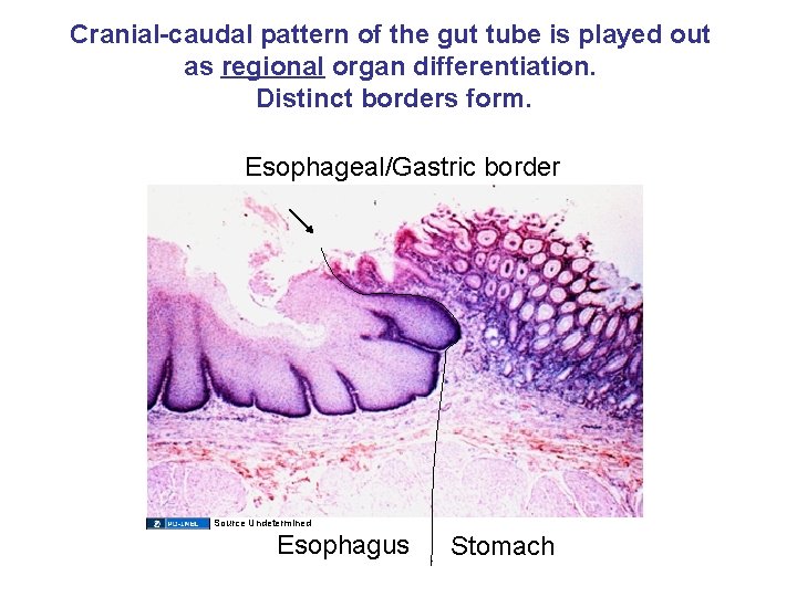 Cranial-caudal pattern of the gut tube is played out as regional organ differentiation. Distinct