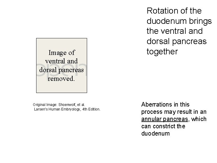 Image of ventral and dorsal pancreas removed. Original Image: Shoenwolf, et al. Larsen’s Human