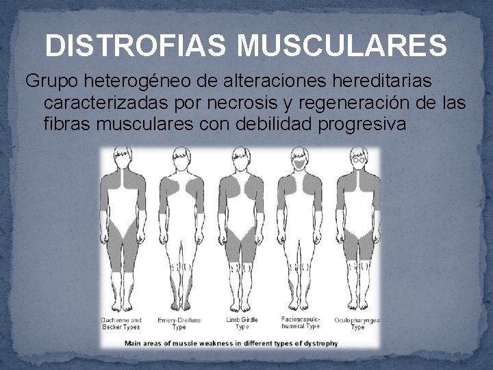 DISTROFIAS MUSCULARES Grupo heterogéneo de alteraciones hereditarias caracterizadas por necrosis y regeneración de las