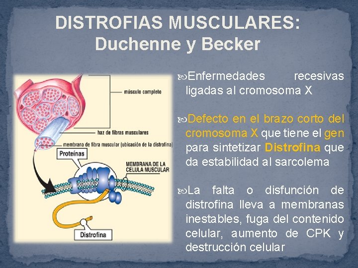 DISTROFIAS MUSCULARES: Duchenne y Becker Enfermedades recesivas ligadas al cromosoma X Defecto en el