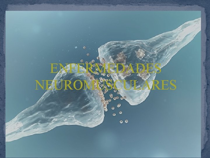 ENFERMEDADES NEUROMUSCULARES 