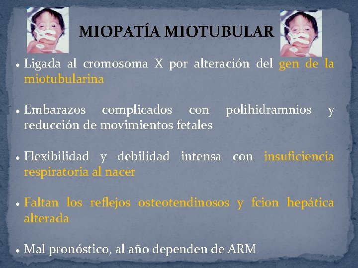 MIOPATÍA MIOTUBULAR l l l Ligada al cromosoma X por alteración del gen de