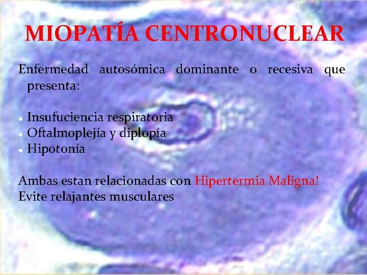 MIOPATÍA CENTRONUCLEAR Enfermedad autosómica dominante o recesiva que presenta: l l l Insufuciencia respiratoria