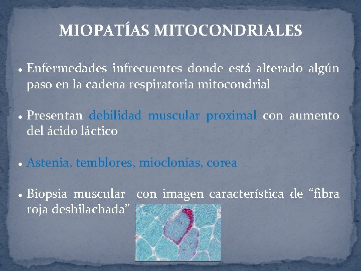 MIOPATÍAS MITOCONDRIALES l l Enfermedades infrecuentes donde está alterado algún paso en la cadena