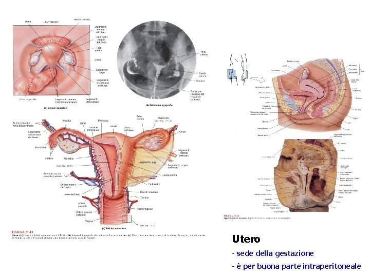 Utero - sede della gestazione - è per buona parte intraperitoneale 