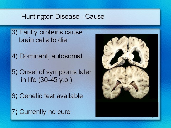 Huntington Disease - Cause 3) Faulty proteins cause brain cells to die 4) Dominant,