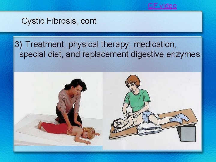 CF video Cystic Fibrosis, cont 3) Treatment: physical therapy, medication, special diet, and replacement