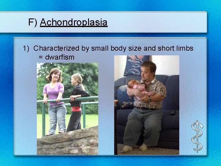 F) Achondroplasia 1) Characterized by small body size and short limbs = dwarfism 