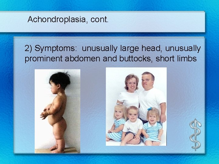 Achondroplasia, cont. 2) Symptoms: unusually large head, unusually prominent abdomen and buttocks, short limbs