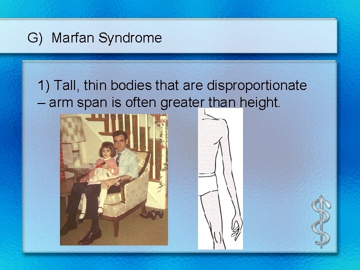 G) Marfan Syndrome 1) Tall, thin bodies that are disproportionate – arm span is
