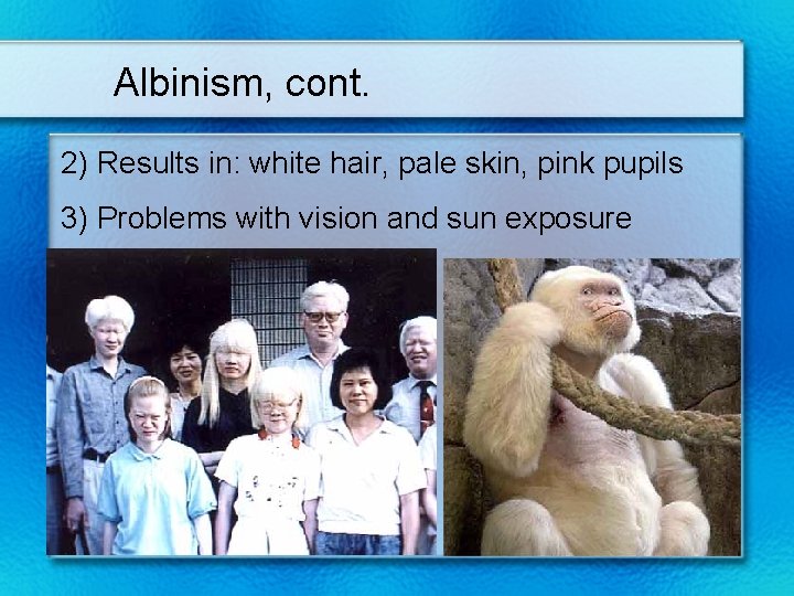 Albinism, cont. 2) Results in: white hair, pale skin, pink pupils 3) Problems with