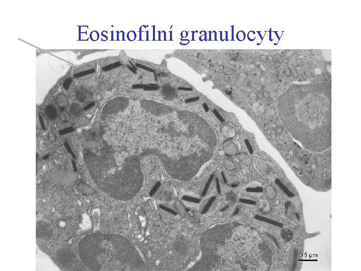 Eosinofilní granulocyty 