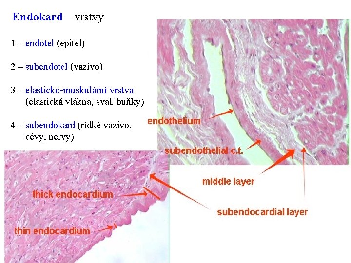 Endokard – vrstvy 1 – endotel (epitel) 2 – subendotel (vazivo) 3 – elasticko-muskulární