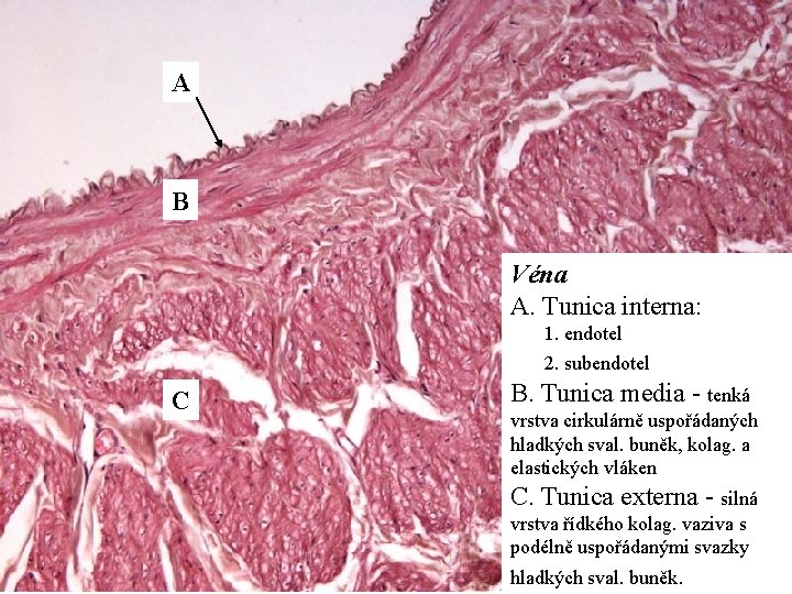 A B Véna A. Tunica interna: 1. endotel 2. subendotel C B. Tunica media