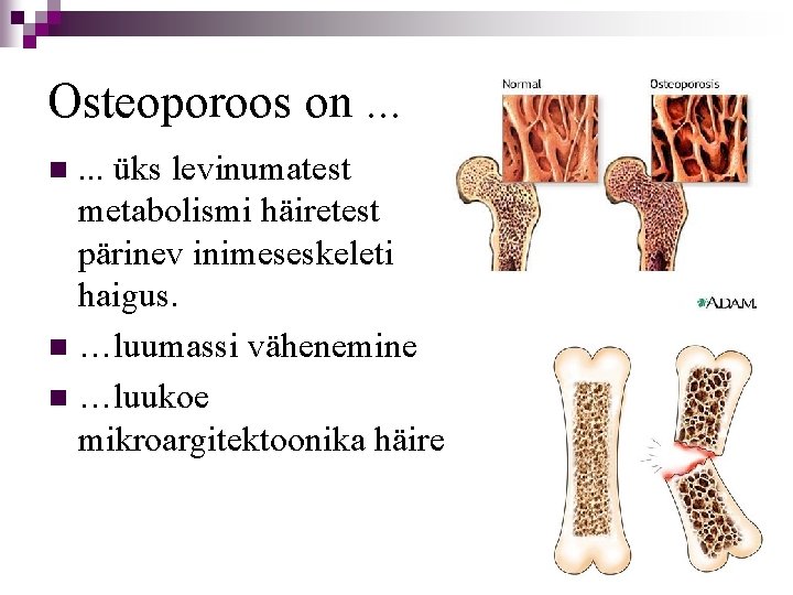 Osteoporoos on. . . üks levinumatest metabolismi häiretest pärinev inimeseskeleti haigus. n …luumassi vähenemine