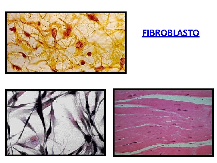 FIBROBLASTO 