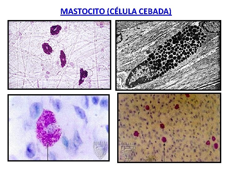 MASTOCITO (CÉLULA CEBADA) 