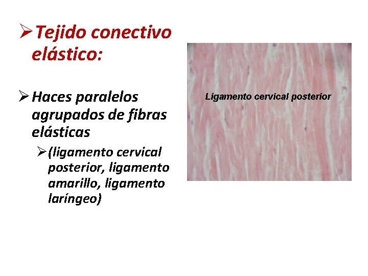 ØTejido conectivo elástico: Ø Haces paralelos agrupados de fibras elásticas Ø(ligamento cervical posterior, ligamento