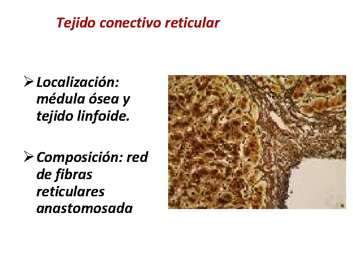 Tejido conectivo reticular Ø Localización: médula ósea y tejido linfoide. Ø Composición: red de