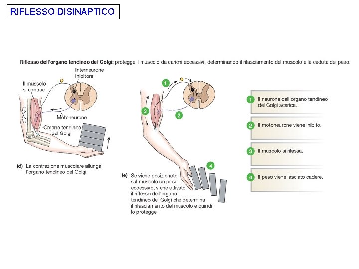 RIFLESSO DISINAPTICO 